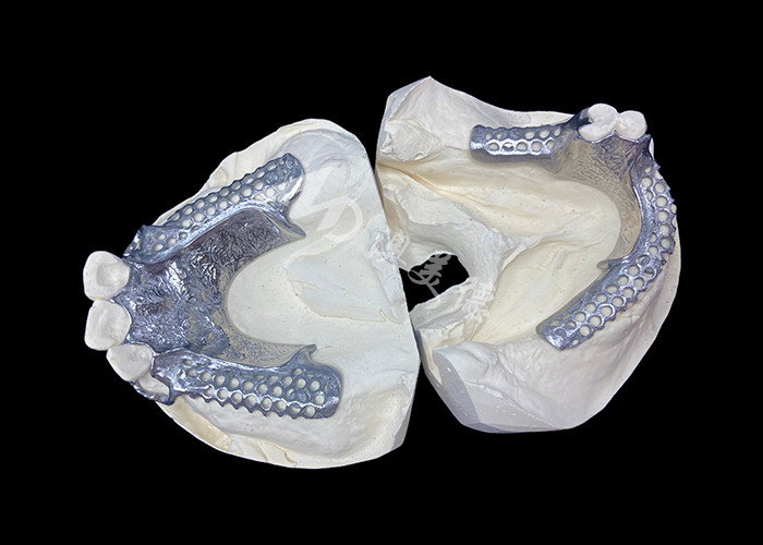 สะดวกสบาย Custom Cast Partial Denture โครงสร้างที่มั่นคงและดูธรรมชาติสําหรับผลการผลิตอย่างรวดเร็ว