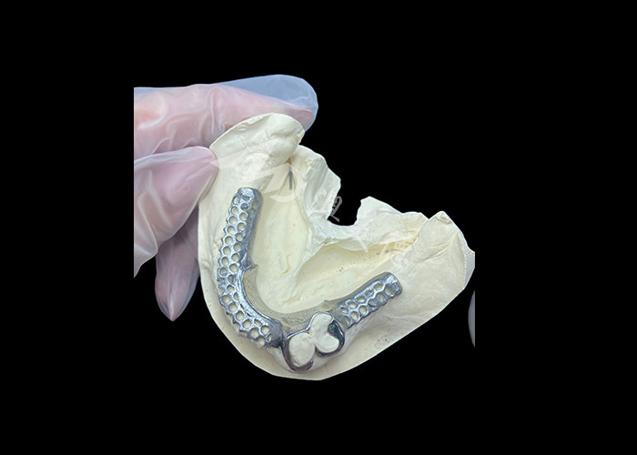 สะดวกสบาย Custom Cast Partial Denture โครงสร้างที่มั่นคงและดูธรรมชาติสําหรับผลการผลิตอย่างรวดเร็ว