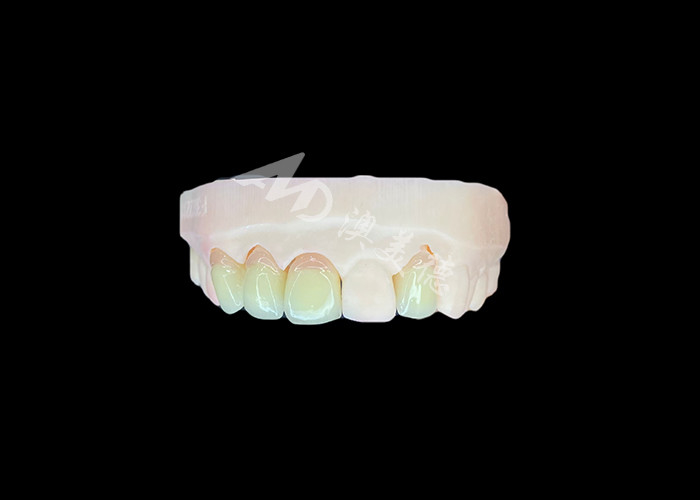 สภาพธรรมชาติและสะดวกสบาย เหมาะสม Zirconia โปรเซลีนมงกุฎ จีนห้องปฏิบัติการฟัน