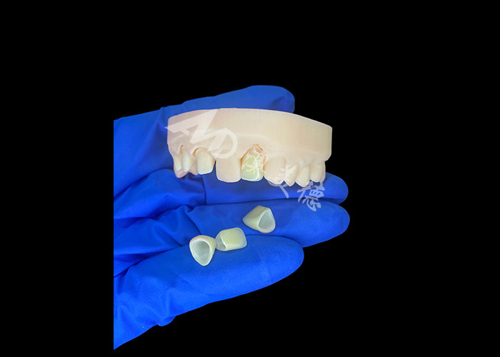 สภาพธรรมชาติและสะดวกสบาย เหมาะสม Zirconia โปรเซลีนมงกุฎ จีนห้องปฏิบัติการฟัน