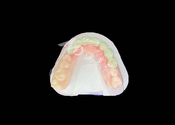Wieland Zenostar Ceramic Crown Bridge ความละเอียดสูงสําหรับการฟื้นฟูที่ทนทานและดูธรรมชาติ