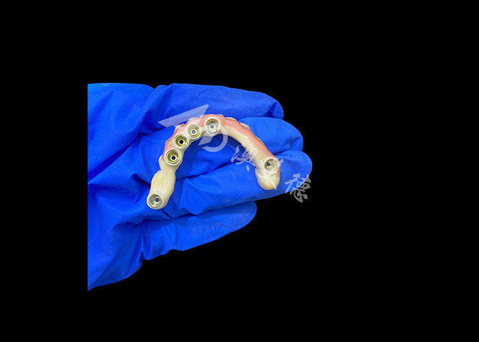 หมึกไทเทเนียมและ Zirconia Crown Implant สนับสนุนฟันเทียม ความแม่นยํา เหมาะสําหรับการสวมใส่ที่สบาย