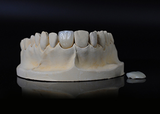 ราคาดี โปรเซลีนโปร่งใส Emax Veneer สําหรับความเหมาะสมที่ดี / สวยงามตามธรรมชาติ ออนไลน์