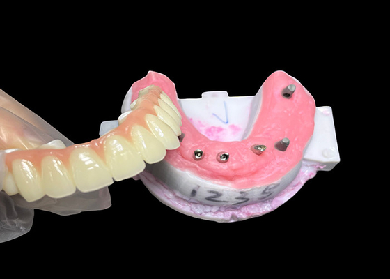 ราคาดี จัดจํากัดการวางเครื่องยนต์ ฟันเทียม Full Arch Fixed Dental Implant Ceramic Crown Bridge ออนไลน์