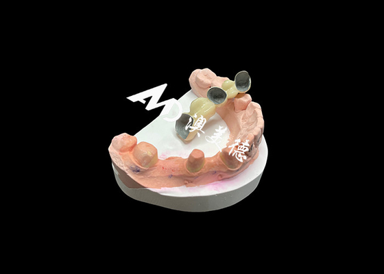 ราคาดี กลมเยื่อผสมผสานโลหะที่ทนทานต่อการกัดกร่อนของ PFM Crown ออนไลน์