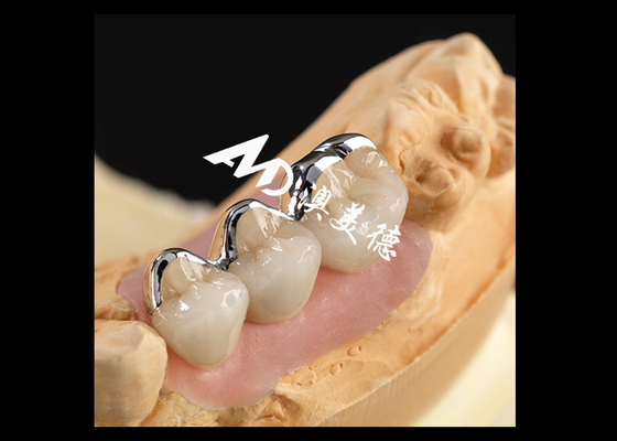 ราคาดี โปรเซลีน PFM แข็งแรงหลอมเข้ากับมงกุฎโลหะ ความเหมาะสมทางชีวภาพที่ดี ทนทานการสวมใส่ ออนไลน์