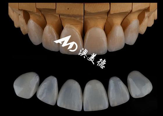 ราคาดี ผนังสี Emax ที่ถูกต้องมาก / ผนังสีฟันโปเซลีน สําหรับฟันเสริม ออนไลน์