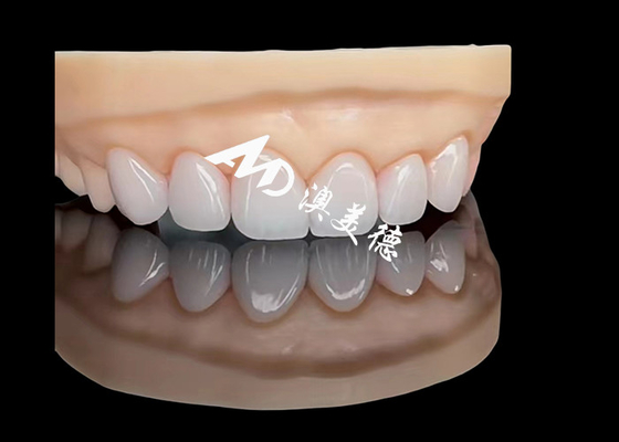 ราคาดี โปรเซลีน EMAX Veneer การฟื้นฟูความสวยงามความละเอียดสูง ออนไลน์