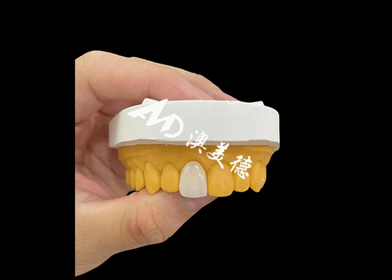 ราคาดี ขาตัดด้านหน้า Zirconia รางวัลฟัน ลักษณะธรรมชาติ ความแข็งแรงสูง ทนทานการใช้งาน ออนไลน์