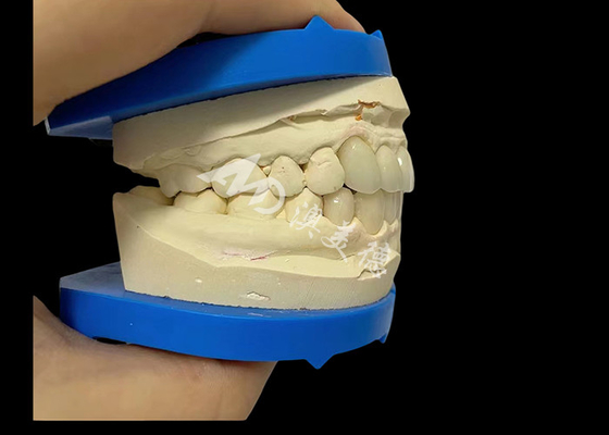 ราคาดี ความแข็งแรงที่ไม่แพ้ ยี่ห้อฟันซิกโคนยา Dentla Crown สําหรับรอยยิ้มที่ดูเป็นธรรมชาติ ออนไลน์