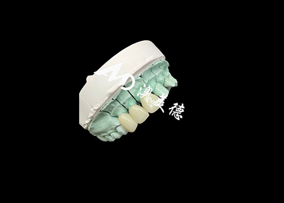 ราคาดี Emax เซรามิก ครอรน โปรแกรมและราคาถูก สําหรับการฟื้นฟูฟัน ออนไลน์