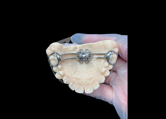 ราคาดี เครื่องขยายปาก MSE อุปกรณ์ Orthodontic นวัตกรรมสําหรับการจัดสรรฟันอย่างมีประสิทธิภาพ ออนไลน์