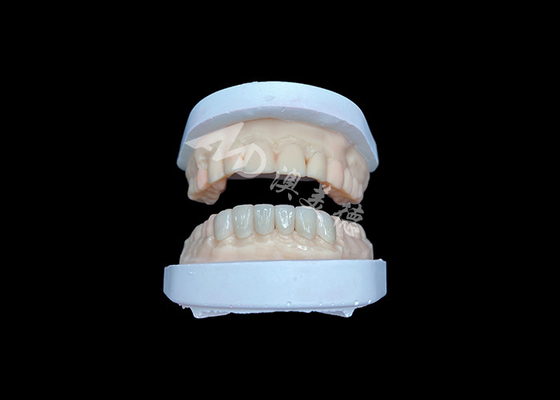 ราคาดี IPS Emax Veneers การฟื้นฟูความเป็นธรรมชาติเพื่อความยิ้มงาม ออนไลน์