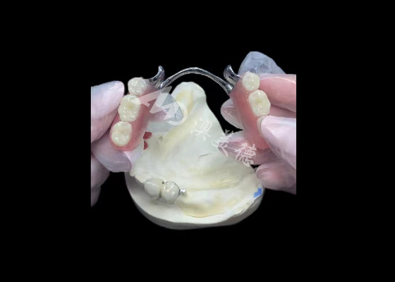 ราคาดี โปรเซลีนทนทานหลอมกับโลหะ ปราสาทฟัน PFM ปราสาทเพื่อการฟื้นฟู ออนไลน์