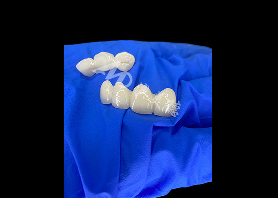 ราคาดี Wieland Zenostar Ceramic Crown Bridge ความละเอียดสูงสําหรับการฟื้นฟูที่ทนทานและดูธรรมชาติ ออนไลน์