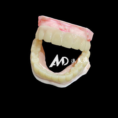 ราคาดี Lightweight PMMA Temporary Bridges with Hollow Design for Implant Restorations ออนไลน์